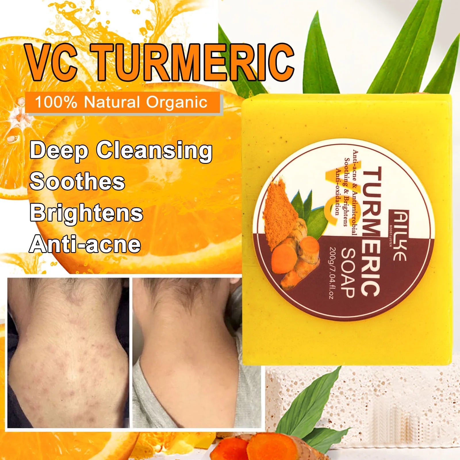 Organic Turmeric Skin Care Kit, Brighten, Remove Darkness, Spots, Acne, Lighten, Hydration, Exfoliate, Even Skin Tone,