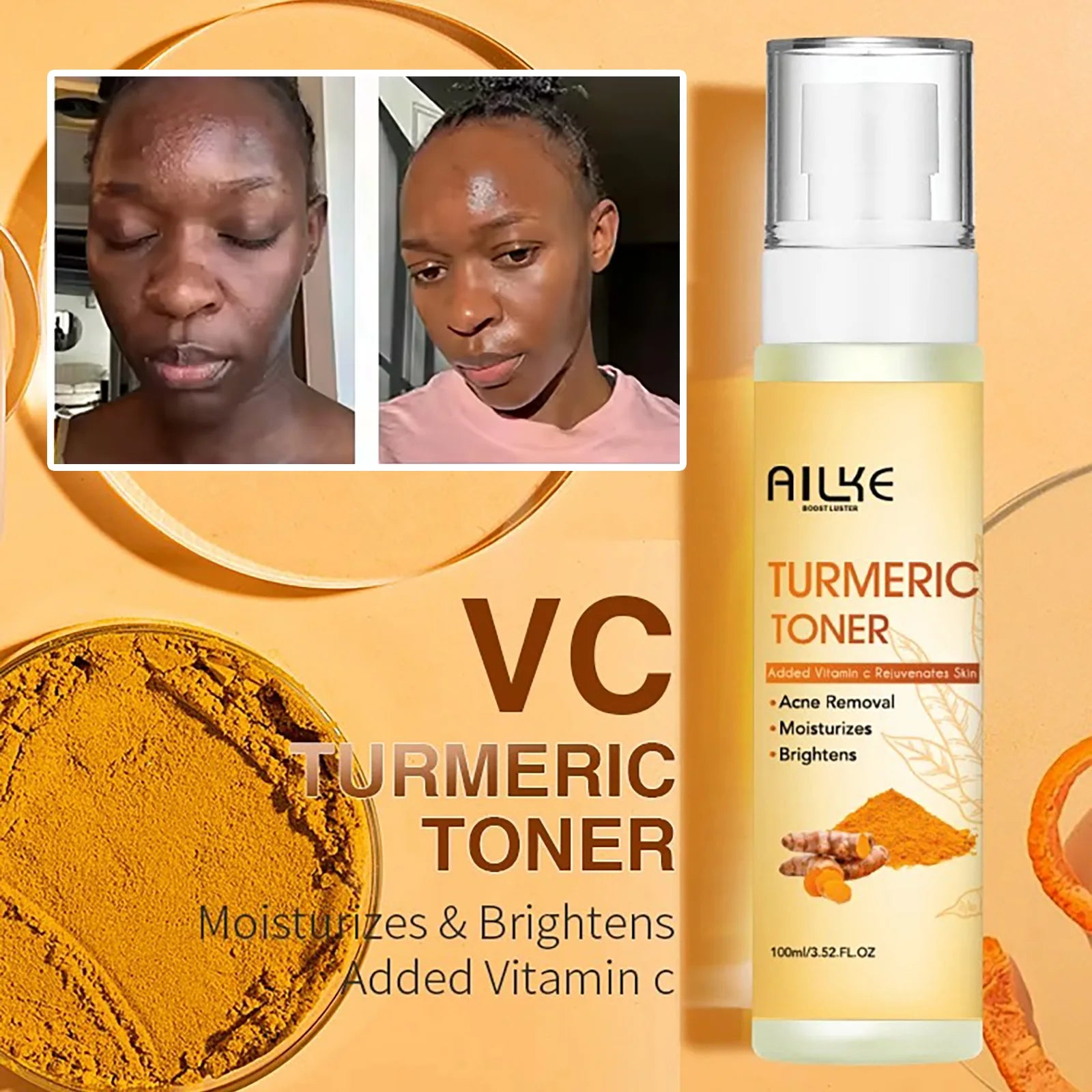 Organic Turmeric Skin Care Kit, Brighten, Remove Darkness, Spots, Acne, Lighten, Hydration, Exfoliate, Even Skin Tone,